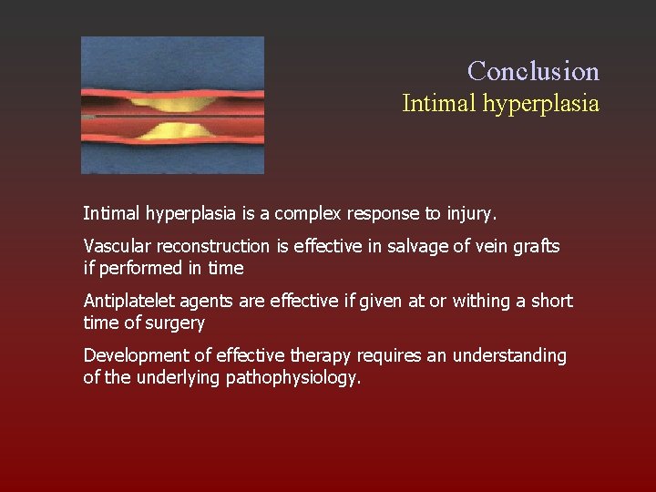 Conclusion Intimal hyperplasia is a complex response to injury. Vascular reconstruction is effective in