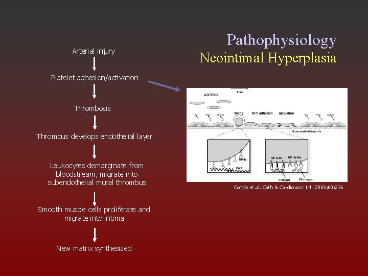 Arterial injury Pathophysiology Neointimal Hyperplasia Platelet adhesion/activation Thrombosis Thrombus develops endothelial layer Leukocytes demarginate