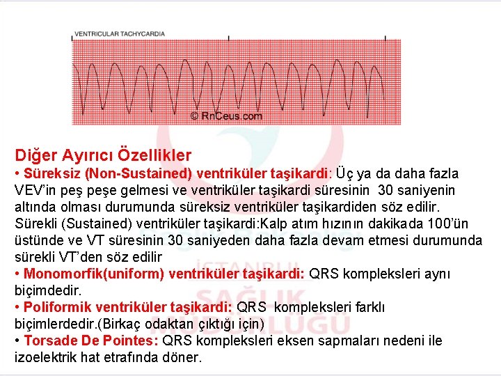Diğer Ayırıcı Özellikler • Süreksiz (Non-Sustained) ventriküler taşikardi: Üç ya da daha fazla VEV’in