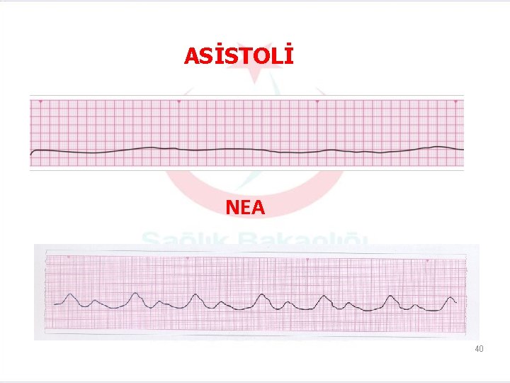 ASİSTOLİ NEA 40 