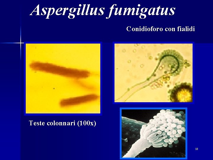 Aspergillus fumigatus Conidioforo con fialidi Teste colonnari (100 x) 18 