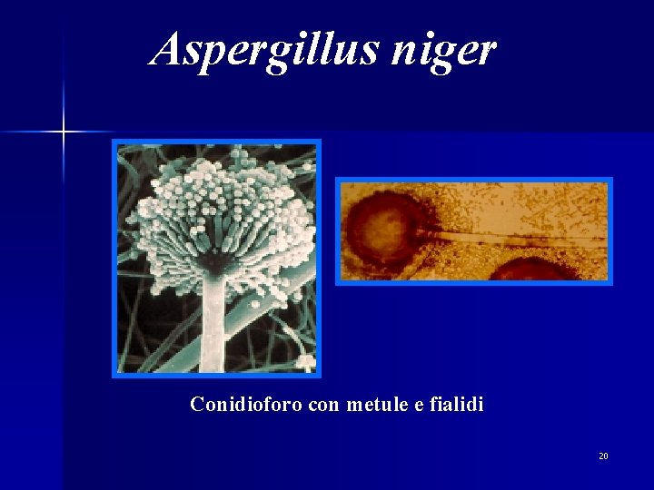 Aspergillus niger Conidioforo con metule e fialidi 20 