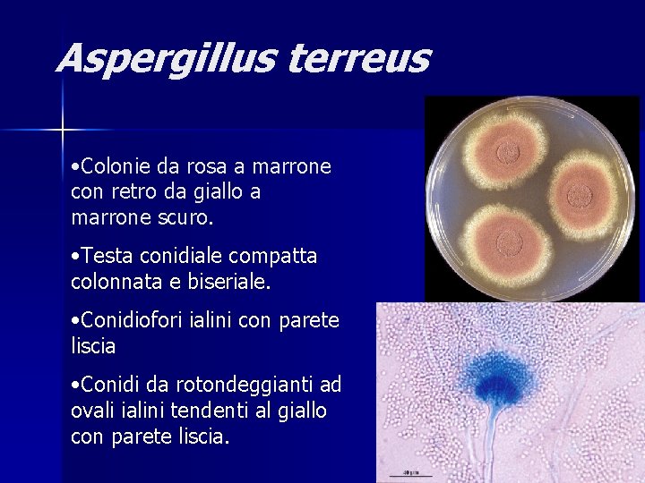Aspergillus terreus • Colonie da rosa a marrone con retro da giallo a marrone