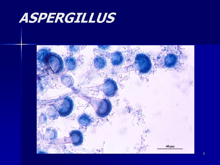 ASPERGILLUS 3 