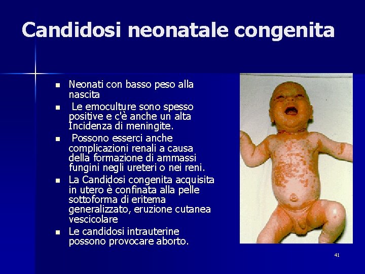 Candidosi neonatale congenita n n n Neonati con basso peso alla nascita Le emoculture