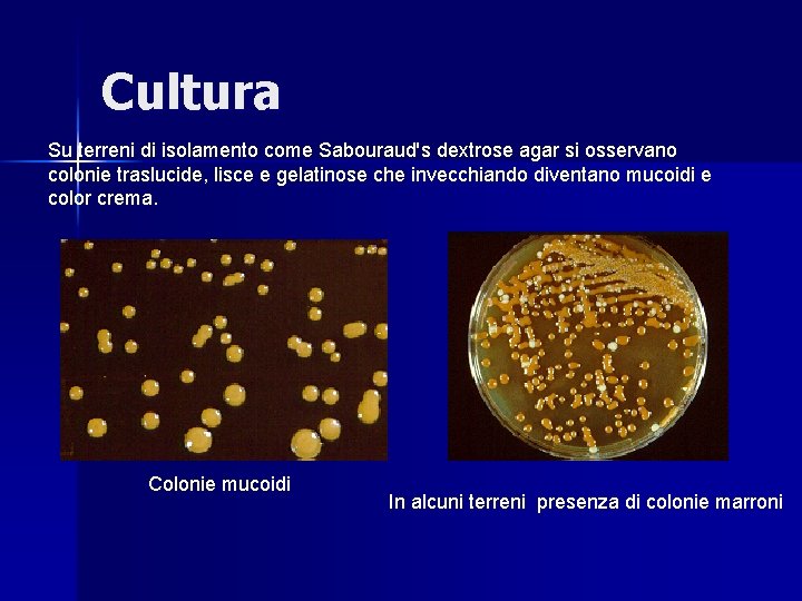 Cultura Su terreni di isolamento come Sabouraud's dextrose agar si osservano colonie traslucide, lisce