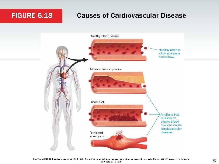 FIGURE 6. 18 Causes of Cardiovascular Disease Copyright © 2016 Cengage Learning. All Rights