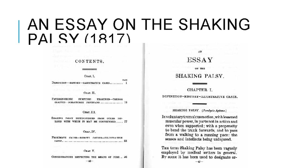 AN ESSAY ON THE SHAKING PALSY (1817) AN ESSAY ON THE SHAKING PALSY (1817)