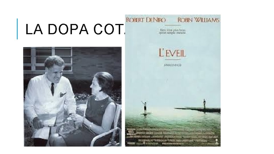 LA DOPA COTZIAS LA DOPA COTZIAS