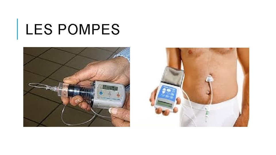 LES POMPES LES POMPES