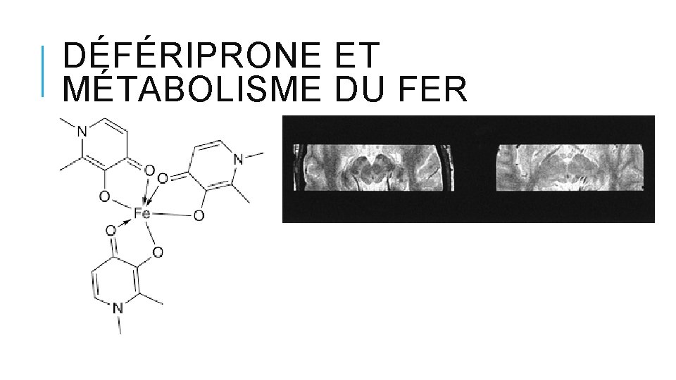 DÉFÉRIPRONE ET MÉTABOLISME DU FER DÉFÉRIPRONE ET MÉTABOLISME DU FER