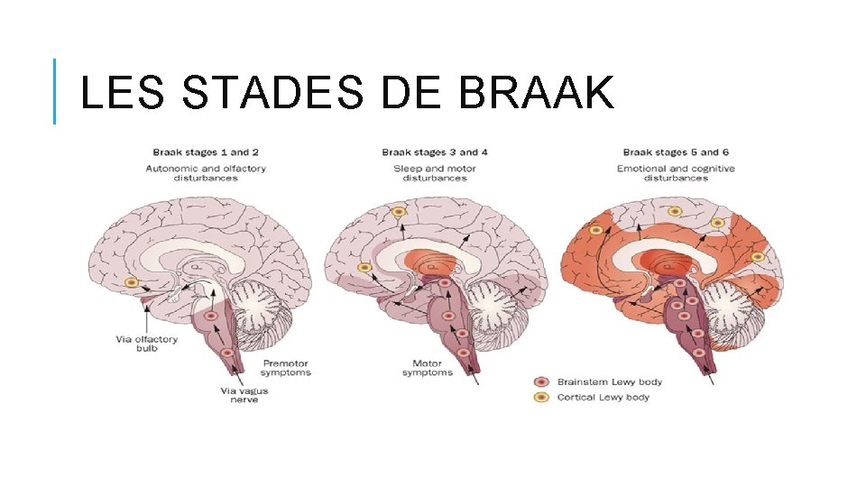 LES STADES DE BRAAK LES STADES DE BRAAK