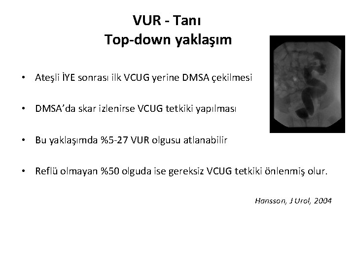 VUR - Tanı Top-down yaklaşım • Ateşli İYE sonrası ilk VCUG yerine DMSA çekilmesi