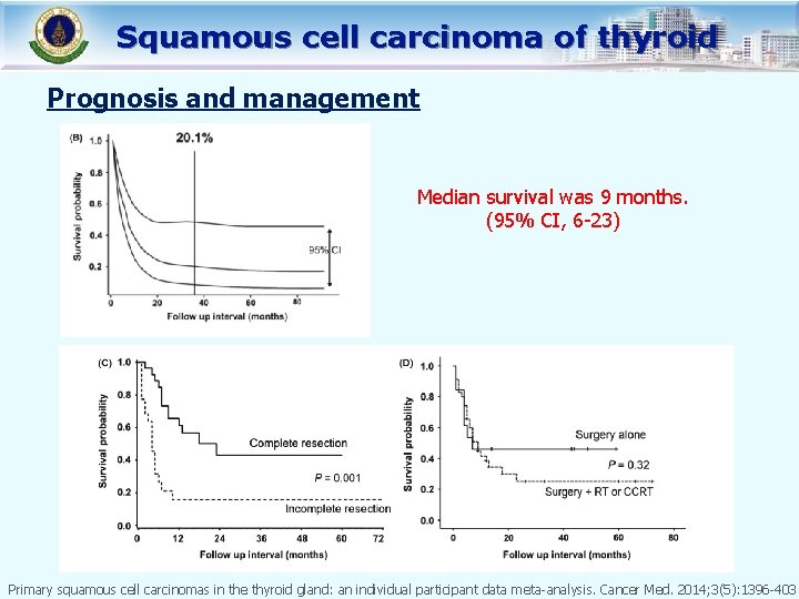 Squamous cell carcinoma of thyroid Prognosis and management Median survival was 9 months. (95%