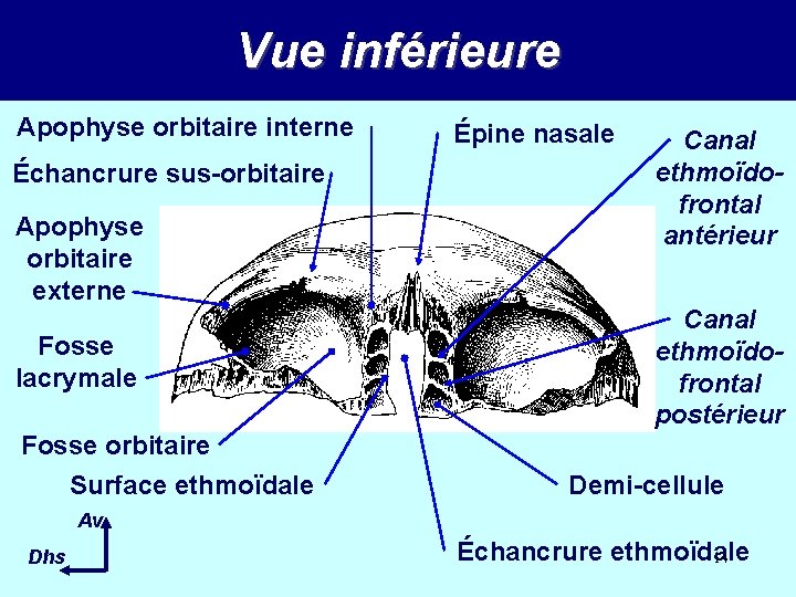 Vue inférieure Apophyse orbitaire interne Échancrure sus-orbitaire Apophyse orbitaire externe Fosse lacrymale Fosse orbitaire Vue inférieure Apophyse orbitaire interne Échancrure sus-orbitaire Apophyse orbitaire externe Fosse lacrymale Fosse orbitaire