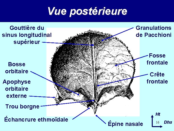 Vue postérieure Gouttière du sinus longitudinal supérieur Granulations de Pacchioni Fosse frontale Bosse orbitaire Vue postérieure Gouttière du sinus longitudinal supérieur Granulations de Pacchioni Fosse frontale Bosse orbitaire