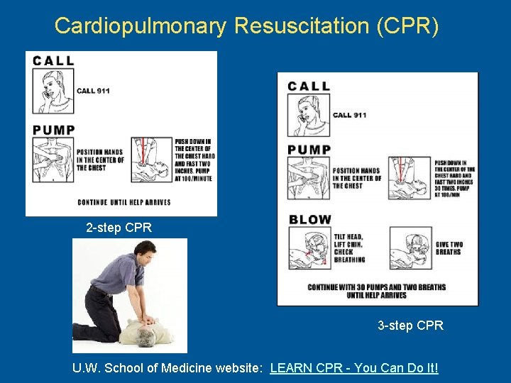 Cardiopulmonary Resuscitation (CPR) 2 -step CPR 3 -step CPR U. W. School of Medicine