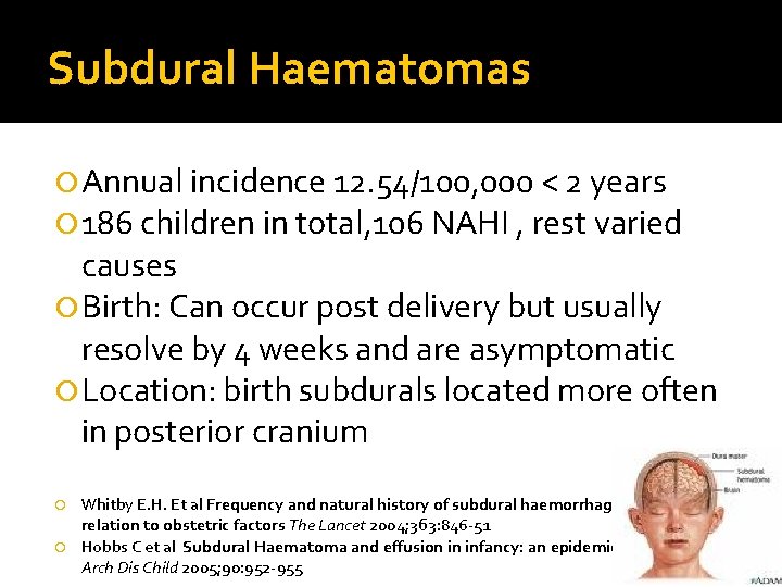 Subdural Haematomas Annual incidence 12. 54/100, 000 < 2 years 186 children in total,