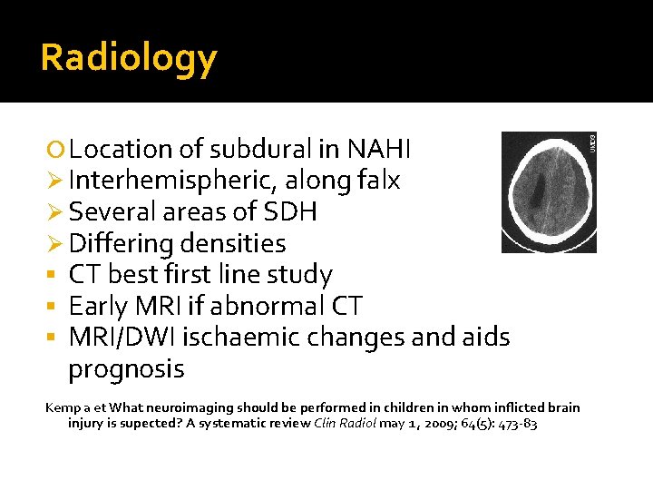 Radiology Location of subdural in NAHI Ø Interhemispheric, along falx Ø Several areas of