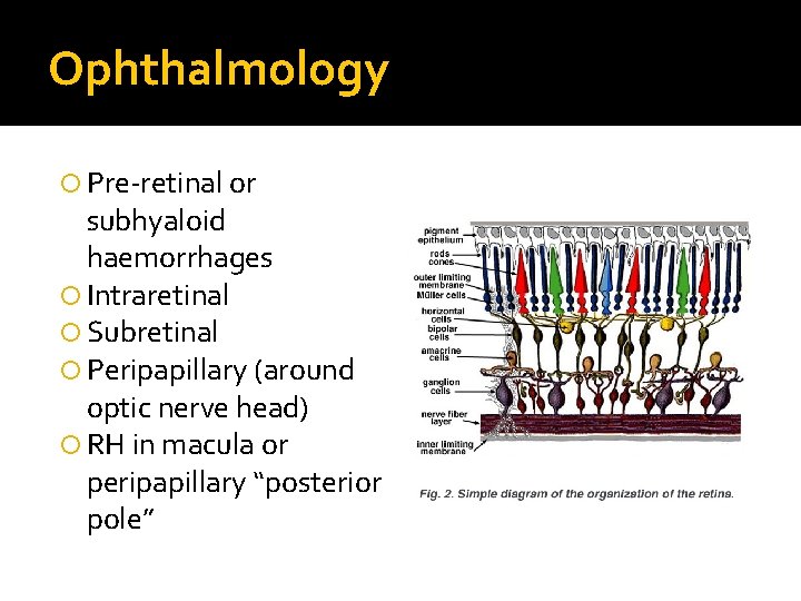 Ophthalmology Pre-retinal or subhyaloid haemorrhages Intraretinal Subretinal Peripapillary (around optic nerve head) RH in
