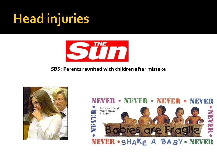 Head injuries SBS: Parents reunited with children after mistake 