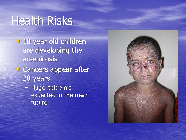 Health Risks • 10 year old children • are developing the arsenicosis Cancers appear