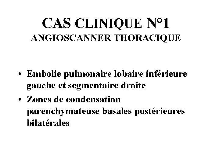 CAS CLINIQUE N° 1 ANGIOSCANNER THORACIQUE • Embolie pulmonaire lobaire inférieure gauche et segmentaire