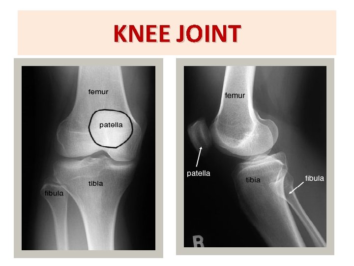 KNEE JOINT 