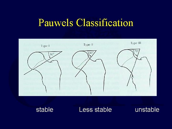 Pauwels Classification Less stable unstable 