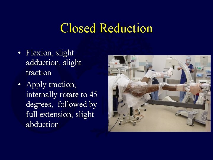 Closed Reduction • Flexion, slight adduction, slight traction • Apply traction, internally rotate to
