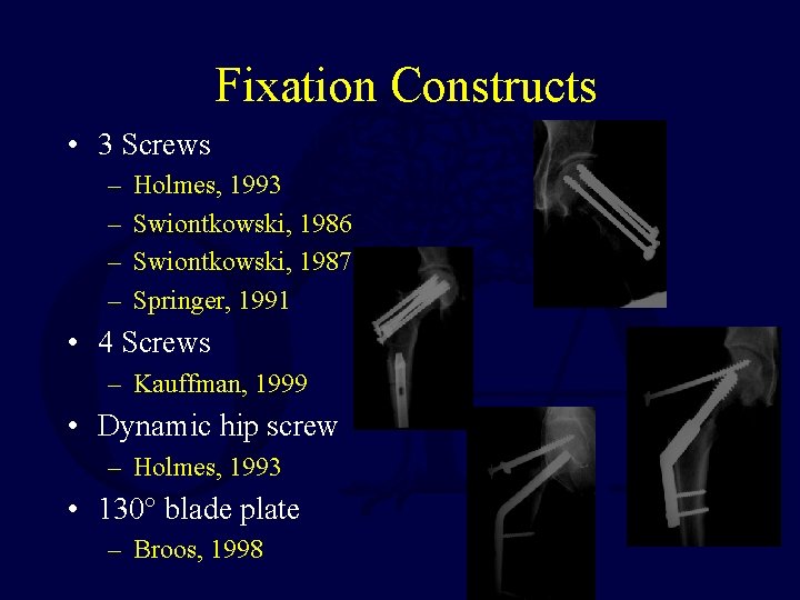 Fixation Constructs • 3 Screws – – Holmes, 1993 Swiontkowski, 1986 Swiontkowski, 1987 Springer,
