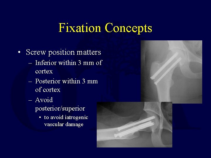 Fixation Concepts • Screw position matters – Inferior within 3 mm of cortex –