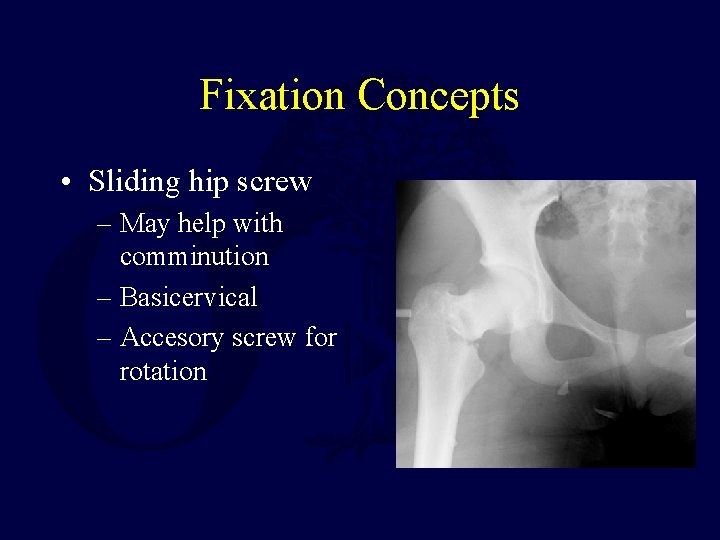 Fixation Concepts • Sliding hip screw – May help with comminution – Basicervical –