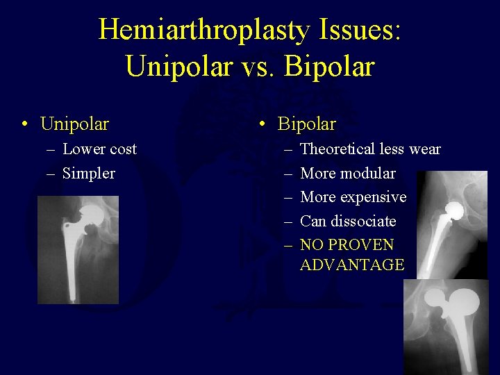 Hemiarthroplasty Issues: Unipolar vs. Bipolar • Unipolar – Lower cost – Simpler • Bipolar