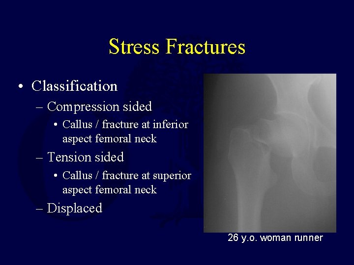Stress Fractures • Classification – Compression sided • Callus / fracture at inferior aspect