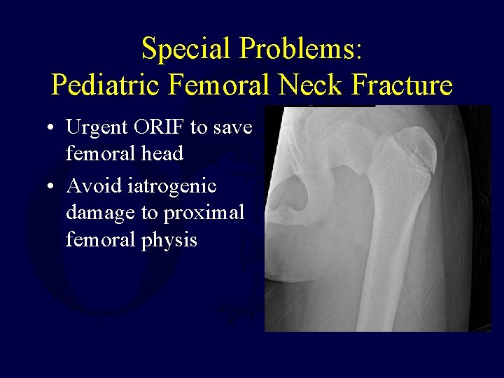 Special Problems: Pediatric Femoral Neck Fracture • Urgent ORIF to save femoral head •