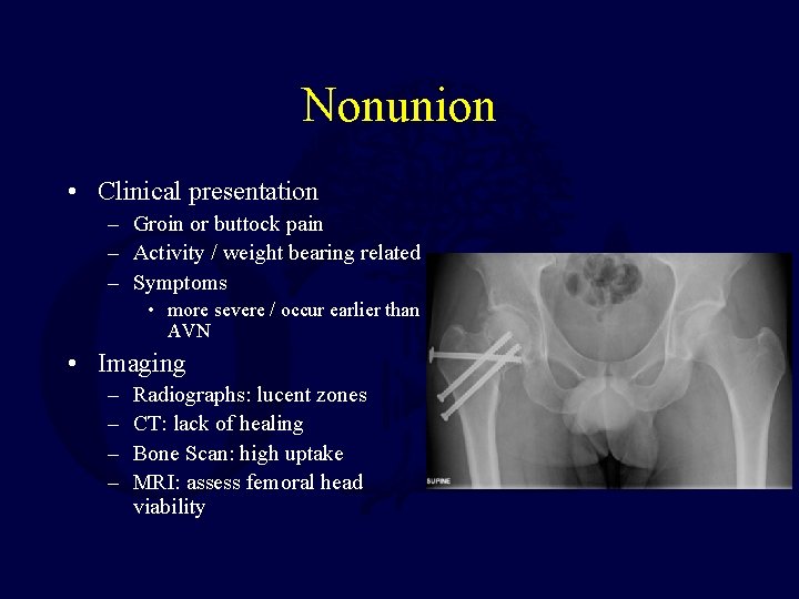 Nonunion • Clinical presentation – Groin or buttock pain – Activity / weight bearing