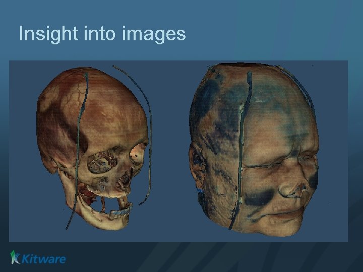 Insight into images 