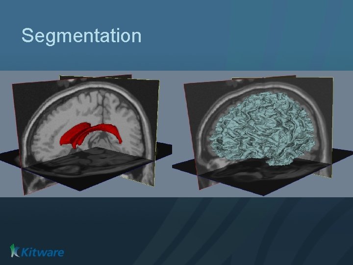 Segmentation 