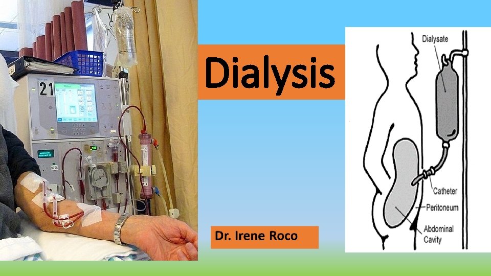 Dialysis 