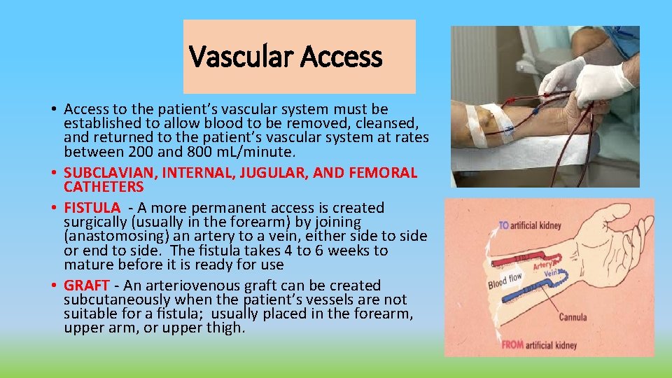 Vascular Access • Access to the patient’s vascular system must be established to allow