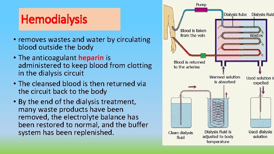 Hemodialysis • removes wastes and water by circulating blood outside the body • The