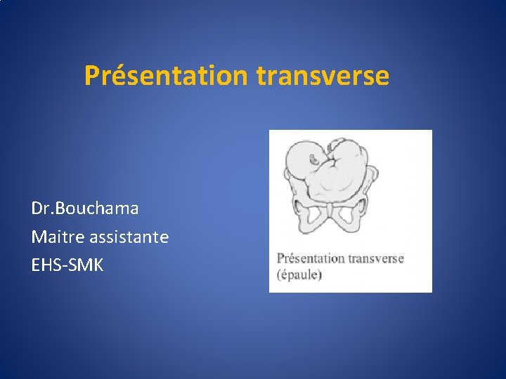 Présentation transverse Dr. Bouchama Maitre assistante EHS-SMK 