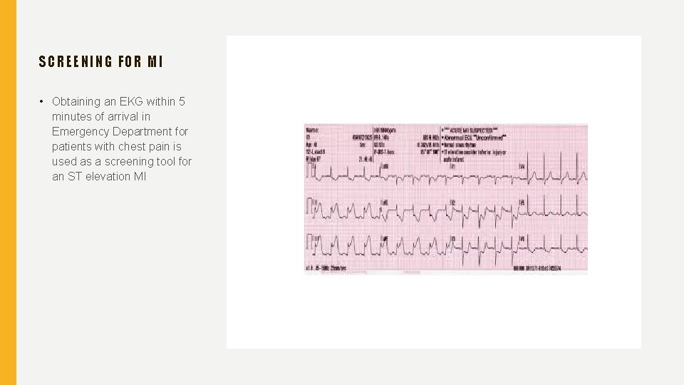 SCREENIN G FOR MI • Obtaining an EKG within 5 minutes of arrival in