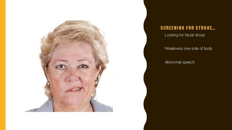 SCREENING FOR STROKE… • Looking for facial droop • Weakness one side of body