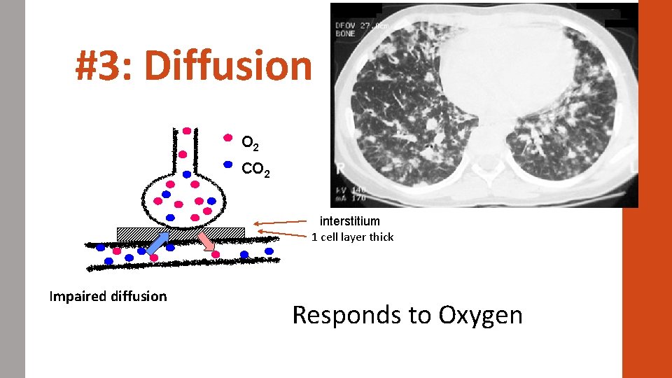 #3: Diffusion O 2 CO 2 interstitium 1 cell layer thick Impaired diffusion Responds