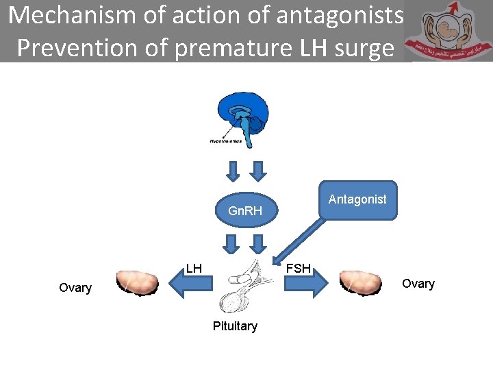 Mechanism of action of antagonists Prevention of premature LH surge Antagonist Gn. RH LH