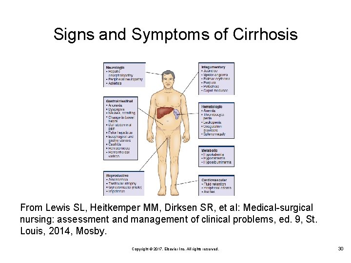 Signs and Symptoms of Cirrhosis From Lewis SL, Heitkemper MM, Dirksen SR, et al: