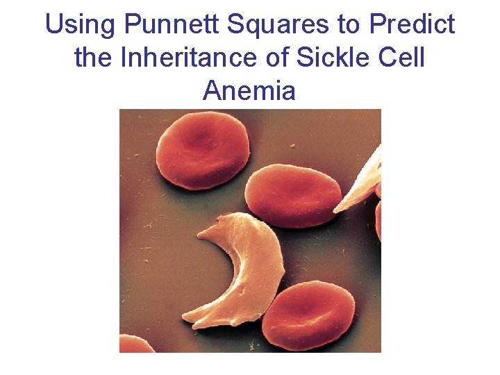 Using Punnett Squares to Predict the Inheritance of Sickle Cell Anemia 