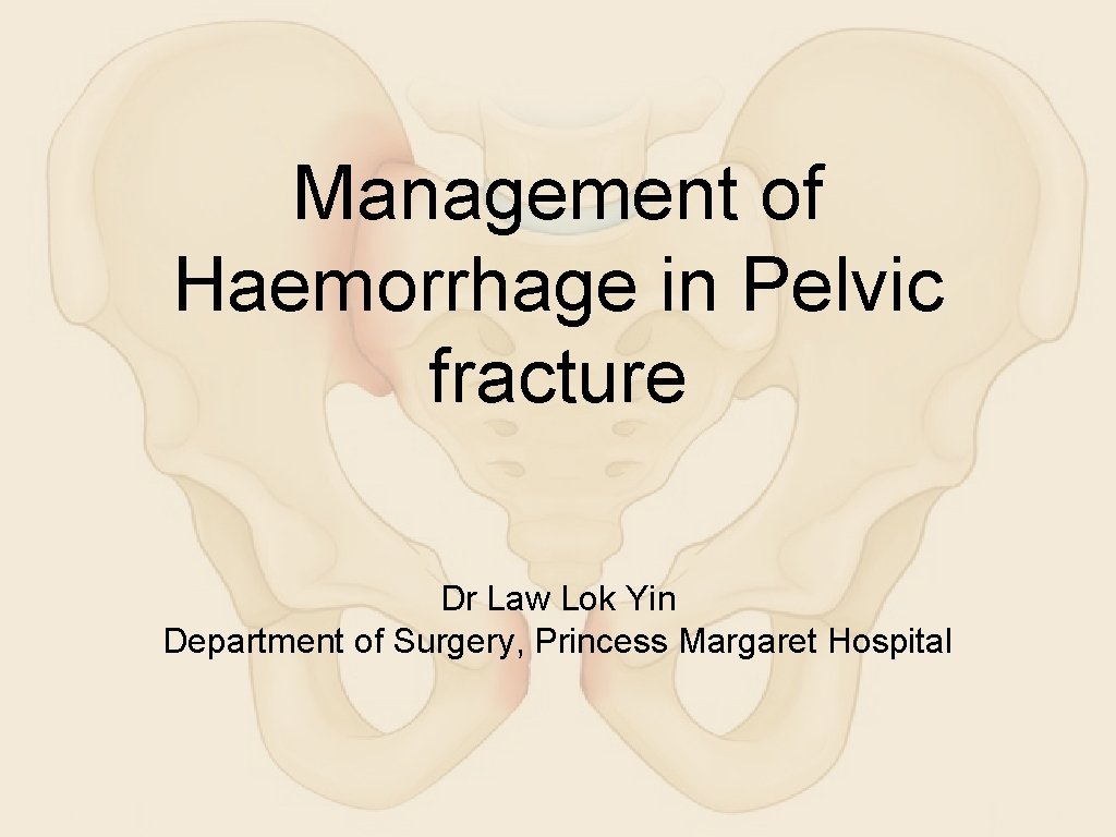 Management of Haemorrhage in Pelvic fracture Dr Law Lok Yin Department of Surgery, Princess